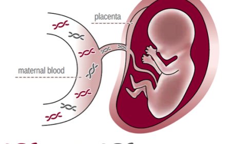 Non-Invasive Prenatal Testing Market Size, Trends, Growth Factors, and Forecast 2025-2033