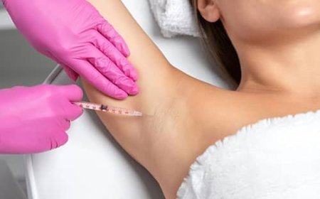 Axillary Hyperhidrosis Treatment - Uptown Med Spa Oakville