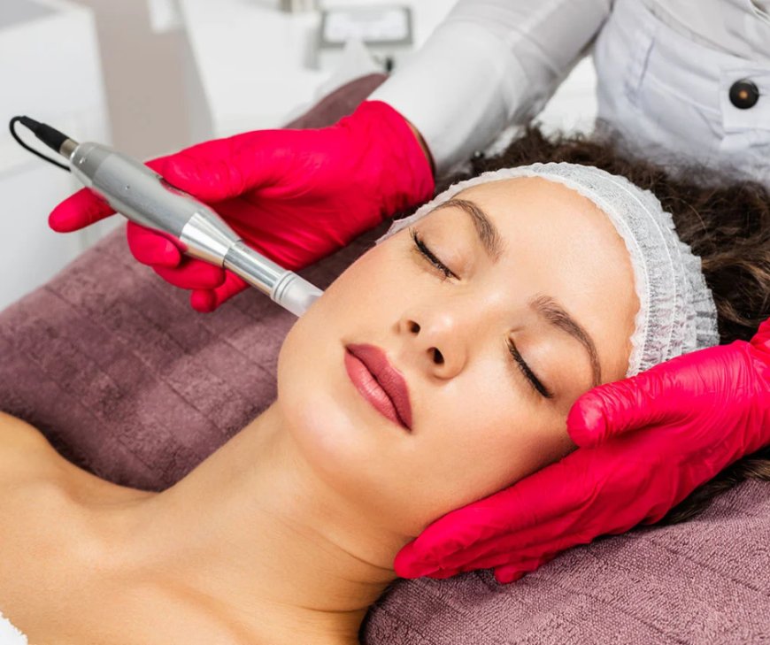Skin Tag Treatment - Uptown Med Spa Oakville