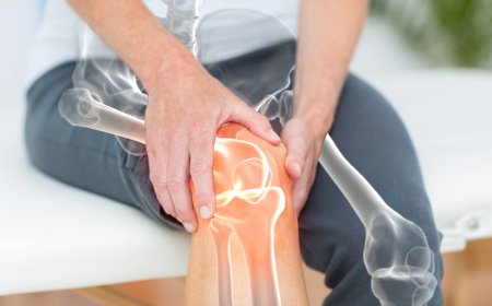 Arthritis Pain? Try These Doctor-Approved Natural Treatments!