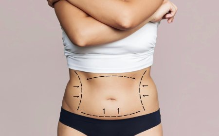 Restoring Body Confidence Through Advanced Body Lify Procedure