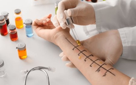 Allergist Doctor Dubai for Food and Environmental Allergies