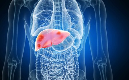Fatty Liver Treatment in Dubai: Improve Liver Function