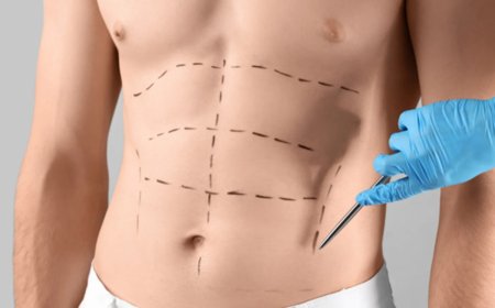 Abdominoplasty Surgery in Islamabad for Complete Body Rejuvenation