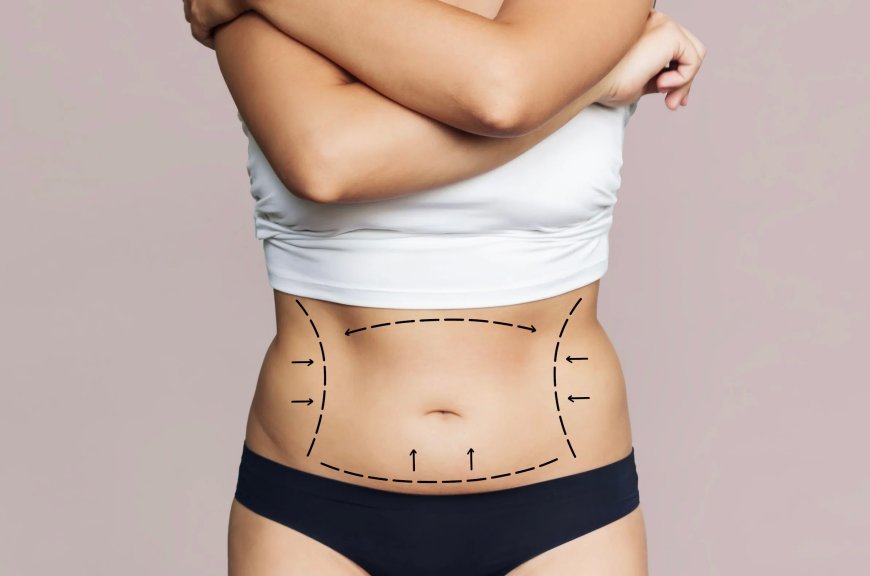 Restoring Body Confidence Through Advanced Body Lify Procedure
