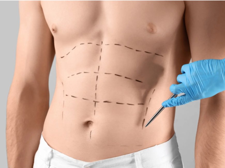 Abdominoplasty Surgery in Islamabad for Complete Body Rejuvenation