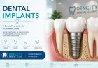 Best Dental Implant Clinic in Bikaner: Your Complete Guide to a Healthy, Confident Smile