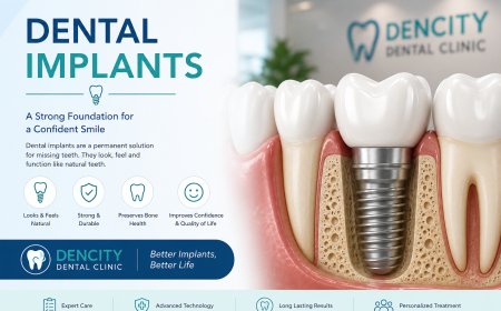 Best Dental Implant Clinic in Bikaner: Your Complete Guide to a Healthy, Confident Smile