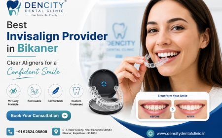 Best Invisible Braces: A Complete Guide to Achieving a Straighter Smile