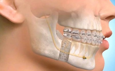 Maxillofacial Surgery vs Oral Surgery: What Is the Difference?
