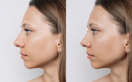 How Our Clinic Supports Patients Through Their Rhinoplasty Journey