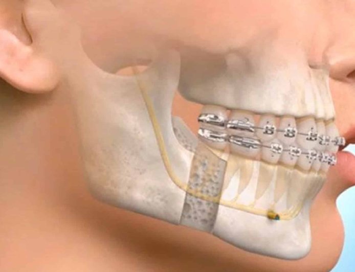 Maxillofacial Surgery vs Oral Surgery: What Is the Difference?
