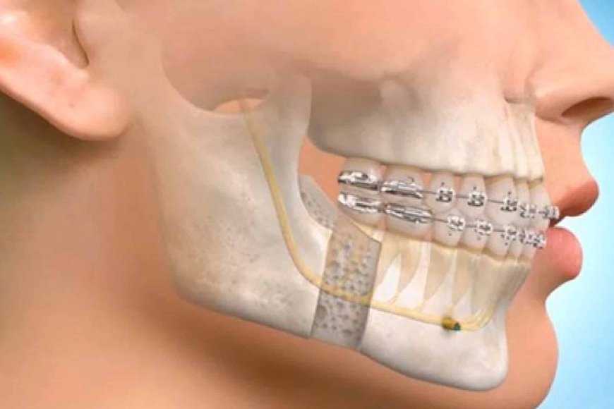Maxillofacial Surgery vs Oral Surgery: What Is the Difference?