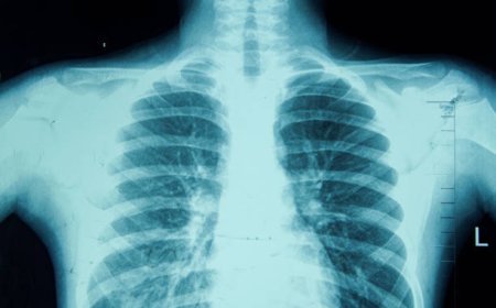 How Digital X-Ray Is Reshaping Vietnam’s Healthcare
