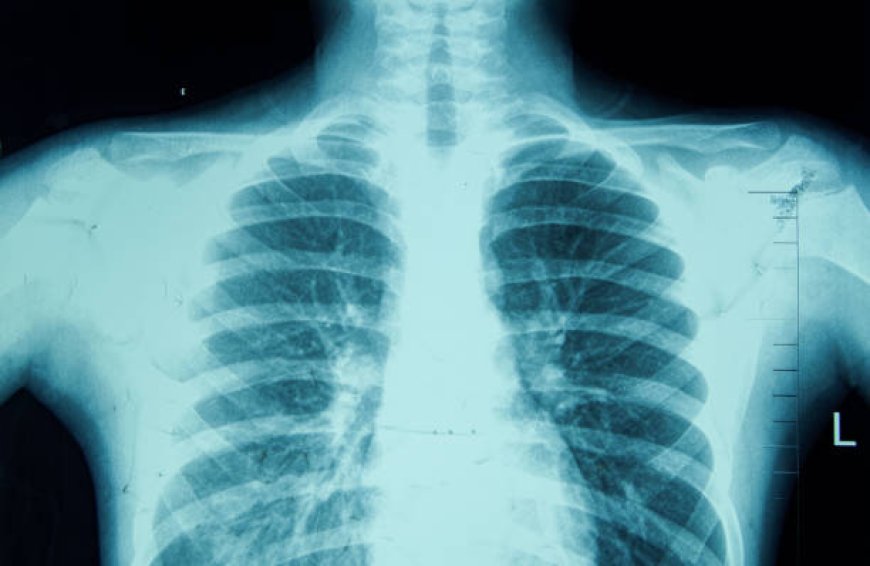 How Digital X-Ray Is Reshaping Vietnam’s Healthcare